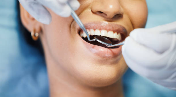 Best Emergency Tooth Extraction in Hotchkiss, CO