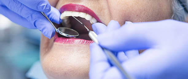 Best Emergency Broken Tooth Repair in Hotchkiss, CO